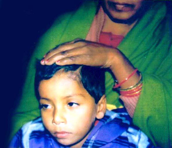 During the treatment 2